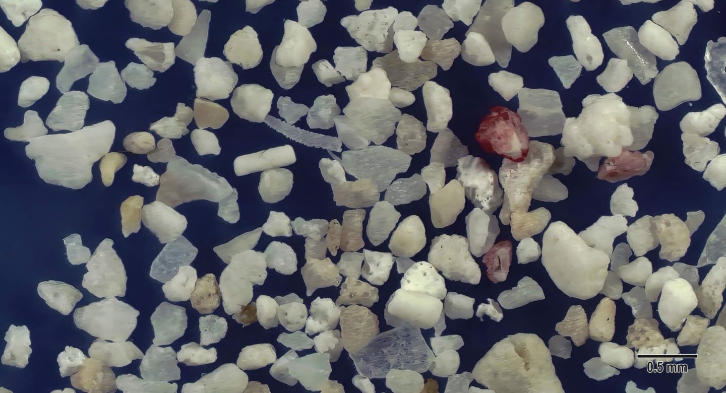 2 Pe Beach, Hateruma Island Japan Sand Grains Magnified Under Microscope 2 Pe Beach, Hateruma Island Japan Sand Grains Magnified Under Microscope