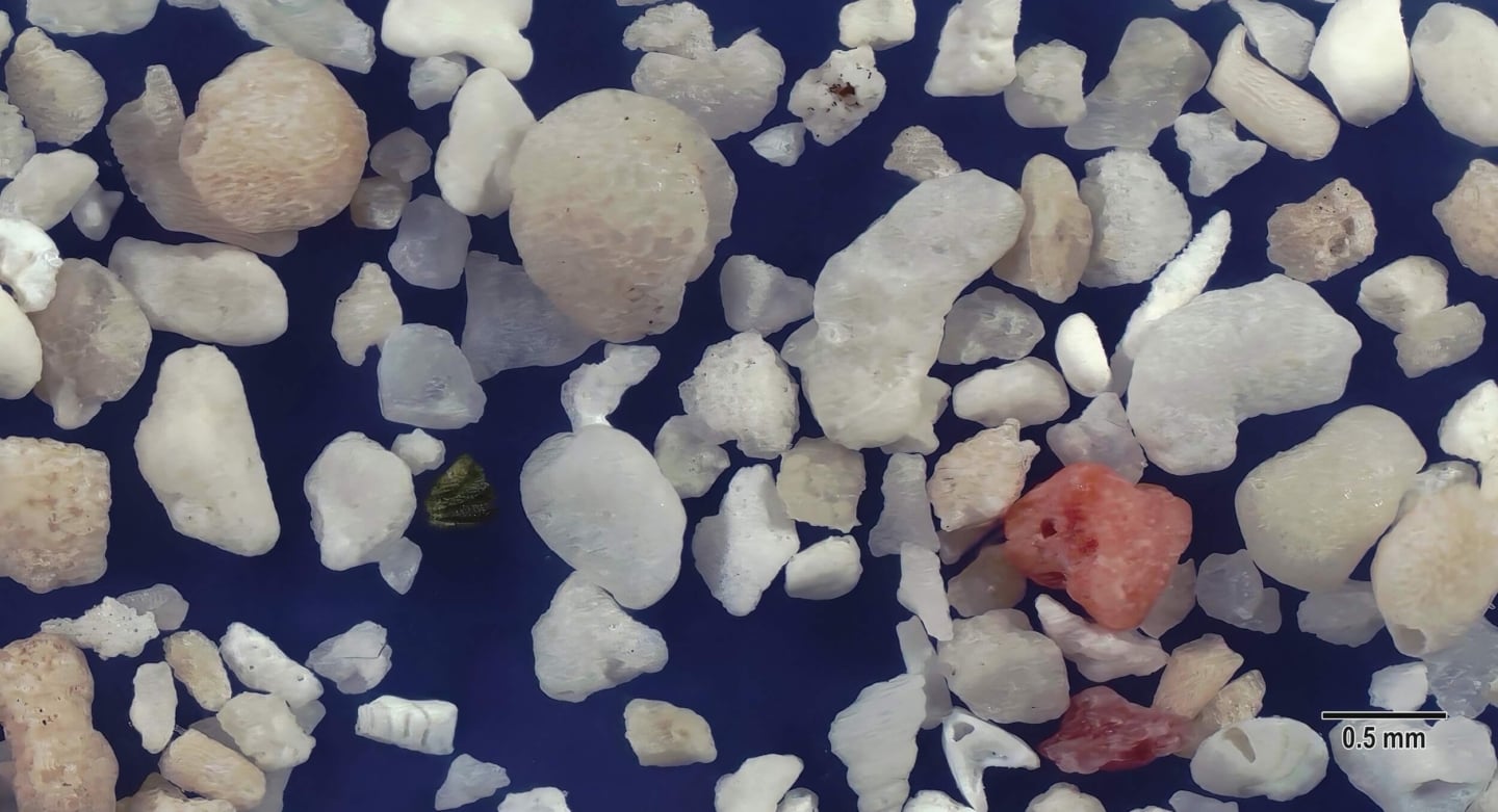 3 Pe Beach, Hateruma Island Japan Sand Grains Magnified Under Microscope 3 Pe Beach, Hateruma Island Japan Sand Grains Magnified Under Microscope