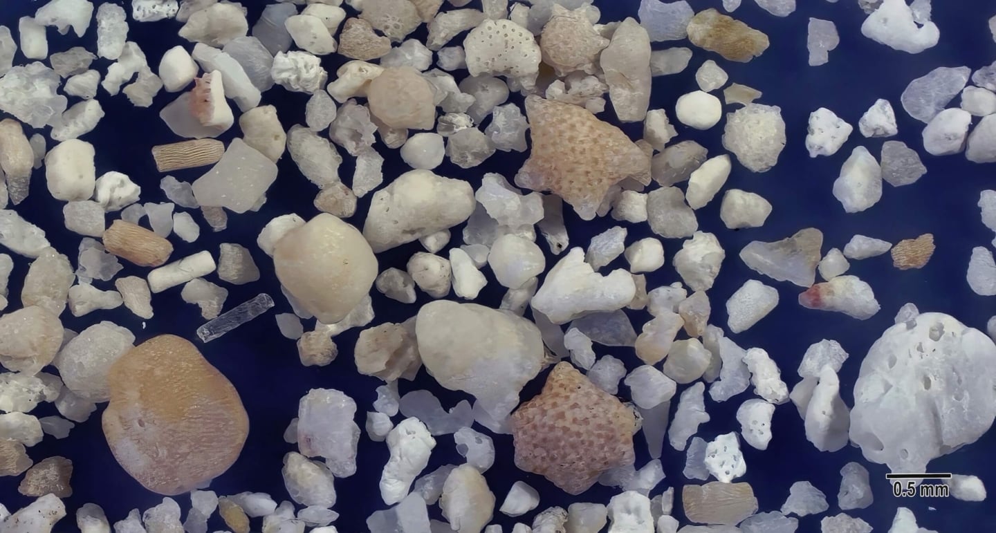 6 Pe Beach, Hateruma Island Japan Sand Grains Magnified Under Microscope 6 Pe Beach, Hateruma Island Japan Sand Grains Magnified Under Microscope