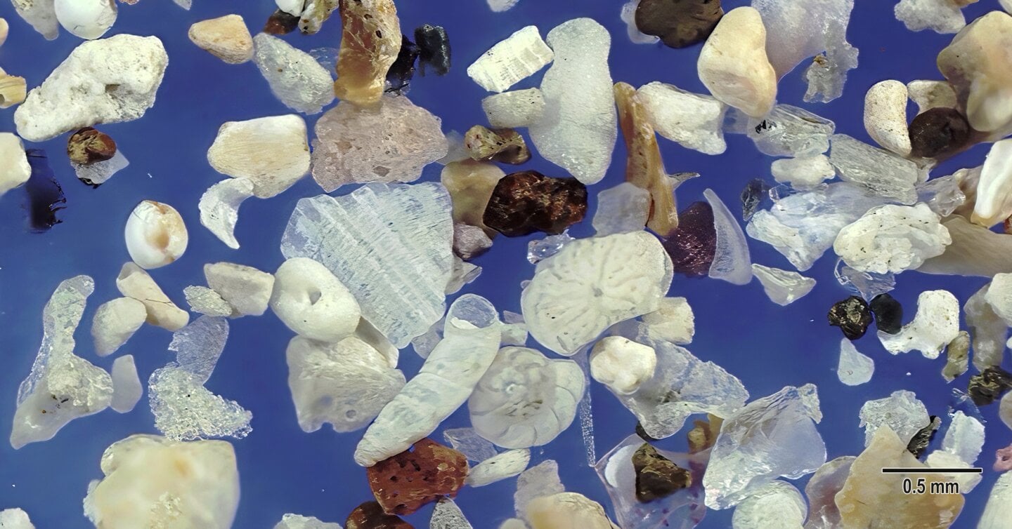 Wakimoto Beach Kagoshima Prefecture Japan Sand Grains Magnified Under Microscope 5 Wakimoto Beach Kagoshima Prefecture Japan Sand Grains Magnified Under Microscope 5